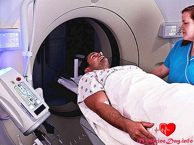 Abdominale CT-scan