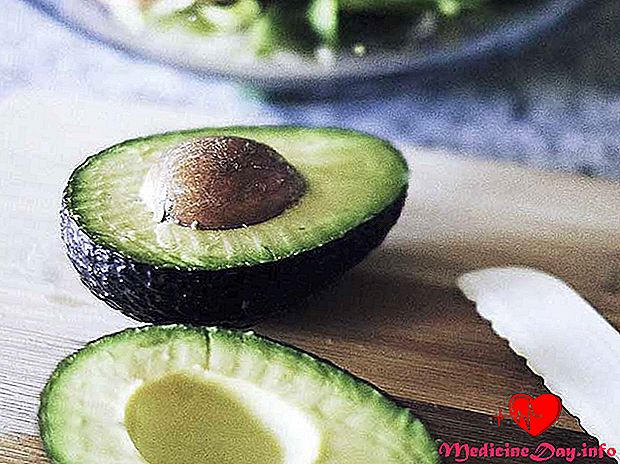 Fordelene og risikoen for avokado for personer med diabetes