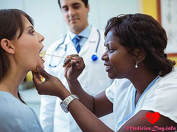 Alles, was Sie über Bifid Uvula wissen sollten
