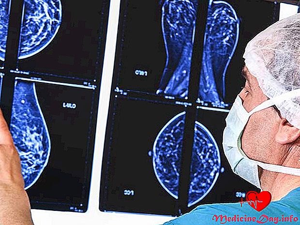 Guide til Mammogrambilder