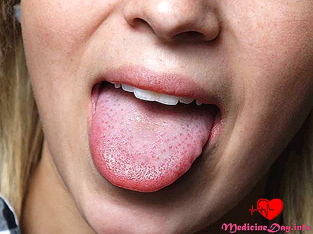 Hvad forårsager min ømme tunge?