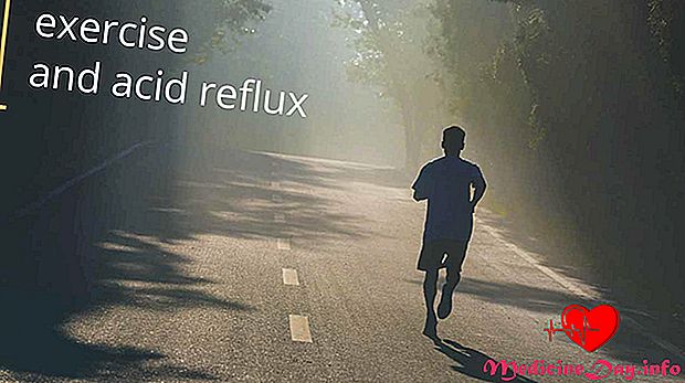 Může cvičení pomoci mé kyselé reflux?