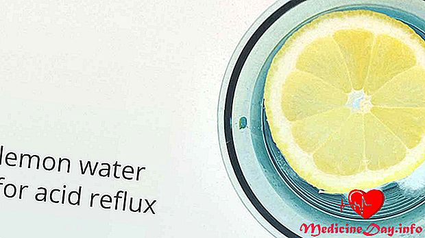 Můžete použít citrónovou vodu na léčbu kyselého refluxu?