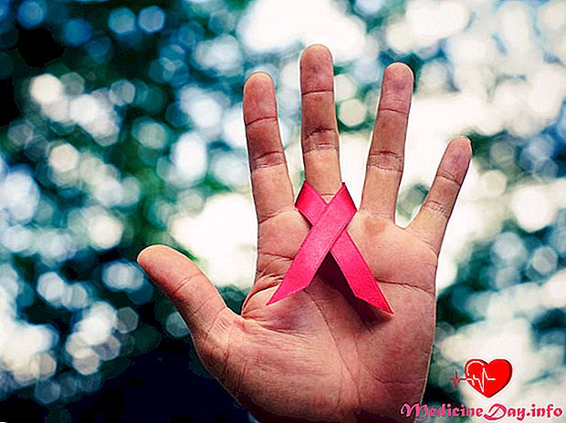HIV vs AIDS: Vad är skillnaden?
