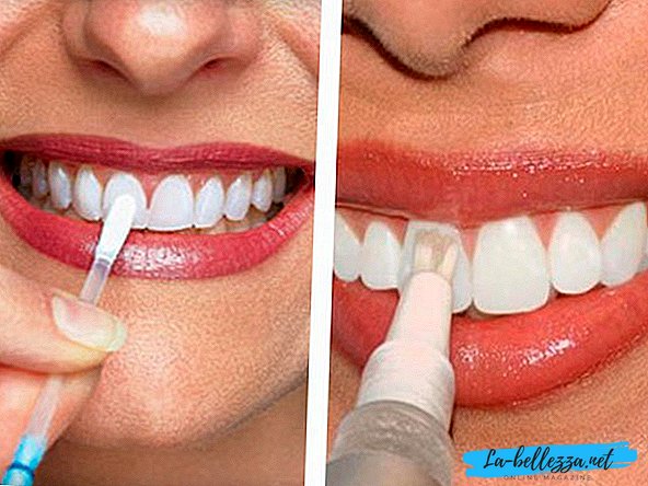 отбеливания зубов содой и перекисью водорода отзывы