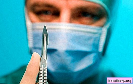 5 incroyables cas d'auto-chirurgie: comment différents médecins se sont opérés