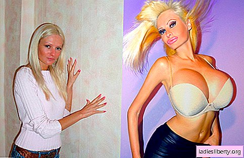 Victim of plastics: for $ 50 thousand, the French model turned itself into a doll