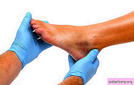 De pink op het been doet pijn - is het erg gevaarlijk? Waarom de pink op het been pijn doet, eerste hulp, naar welke arts en hoe het wordt behandeld