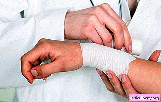 Maux de veines dans les mains: symptômes, causes, principes de base du traitement. Si les veines des bras vous font mal, comment puis-je vous aider - demandez au médecin