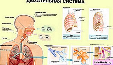 Bronchitis - causes, symptoms, diagnosis, treatment