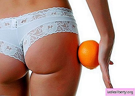 Cellulite How to get rid of cellulite at home