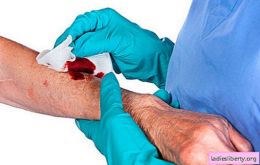 Vad man ska göra om såret inte läker - obligatoriska bearbetningskrav. Om såret har fästat, vad kommer att hjälpa?