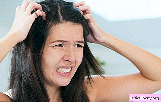 Was wird der Arzt sagen, wenn der Kopf sehr juckt und die Haare ausfallen? Ursachen und Behandlung eines unangenehmen Symptoms: Juckender Kopf und Haarausfall