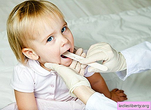 Quelque chose de blanc dans la bouche? Comment traiter le muguet dans la bouche d'un enfant.