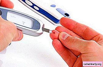 Diabetes - causes, symptoms, diagnosis, treatment