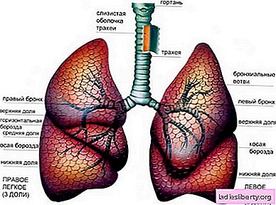 Emphysema - causes, symptoms, diagnosis, treatment