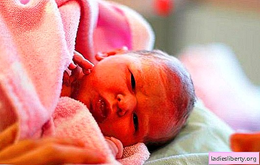 Eritema del recién nacido: causas, tipos y síntomas. ¿Debería tratarse el eritema neonatal: cómo y cómo