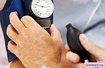 Hypertension artérielle - causes, symptômes, diagnostic, traitement
