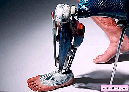 Glamurozne proteze - živo umetniško delo