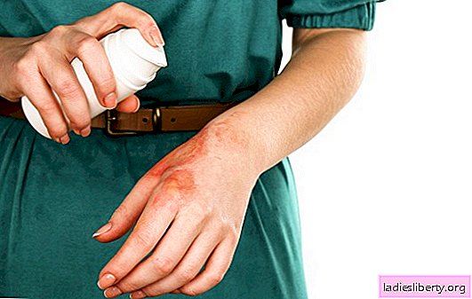 Chemical skin burn: treatment at home. Is it possible to cure a chemical skin burn at home?