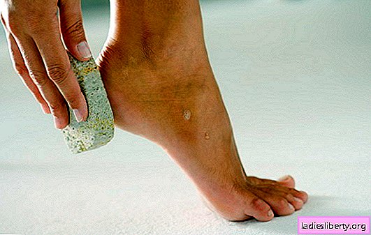 It is not easy to get rid of a crack on the heel - but you can! Heel crack treatment basics: medications and folk remedies