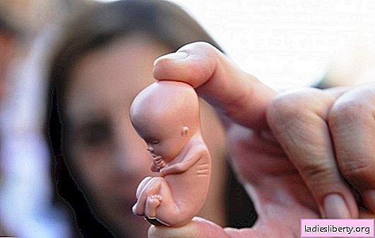 Wovon träumt eine Abtreibung - Empfängnis und Geburt? Die wichtigsten Erklärungen, wovon eine Abtreibung träumt: ein junges Mädchen, eine Frau, ein Mann