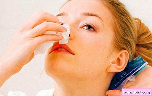 מה החלום של דם מהאף: בבית או באחרים? פירושים בסיסיים לאילו חלומות דם באף