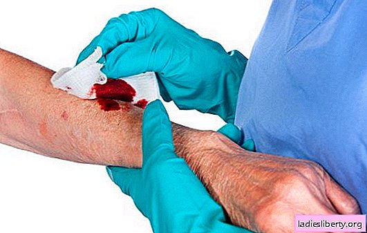 Kodėl sapnuoti žaizdą, pavojingą žaizdą ar paprastą įbrėžimą? Pagrindiniai aiškinimai: apie ką svajoja žaizda ant rankos, kojos ar kūno?