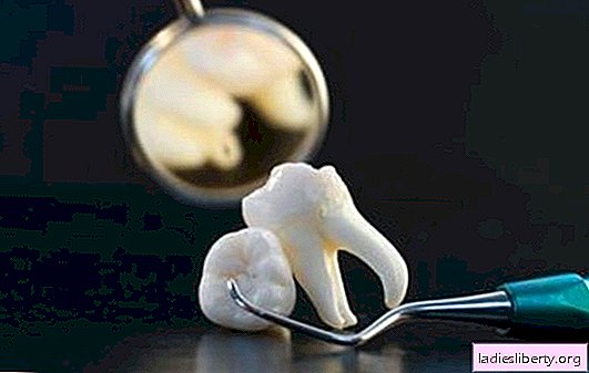 Zakaj sanjati o raztrganem zobu, da bi si zlomil zob sam ali drug? Glavna razlaga o tem, kaj sanjajo vlečenje zob k sebi