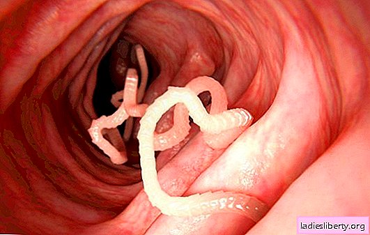 ¿Por qué sueñan los gusanos? Las principales interpretaciones de los diferentes libros de sueños: ¿con qué sueñan los parásitos intestinales?