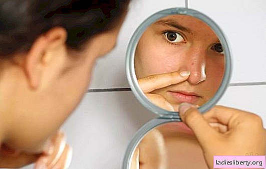Quels sont les rêves d'acné: sur le visage, sur le corps, rouge ou blanc, en soi ou chez une autre personne? Interprétations de base de l'acné