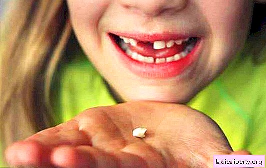 Зашто сањати да зуби испадају без крви? Основно тумачење - зашто сањати да зуби испадају без крви