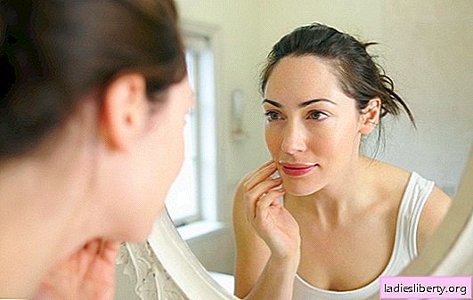 Cómo deshacerse de las marcas de acné: comenzaremos antes, ¡lograremos el éxito más rápido! Eliminamos manchas y cicatrices en la cara después del acné.