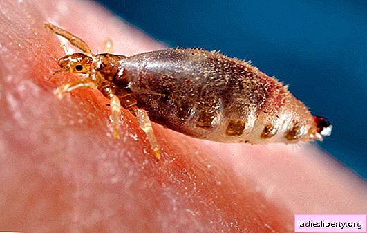 Jak se zbavit vši doma - paraziti na nehty! Rady lékaře, jak se vši zbavit vši: rychle a navždy
