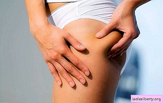 How to do anti-cellulite massage at home is the right technique. The effectiveness of home massage