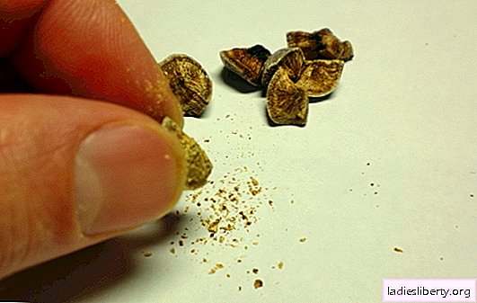 Gallstones: why are they formed? How to treat gallstones and which doctor to go with this problem