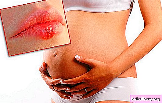 When is herpes on the lips during pregnancy dangerous for the fetus? Methods for the diagnosis and treatment of herpes on the lips during pregnancy