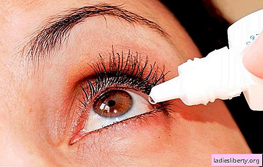 A conjuntivite do olho é uma doença que pode ser efetivamente tratada em casa. Receitas comprovadas de tratamento