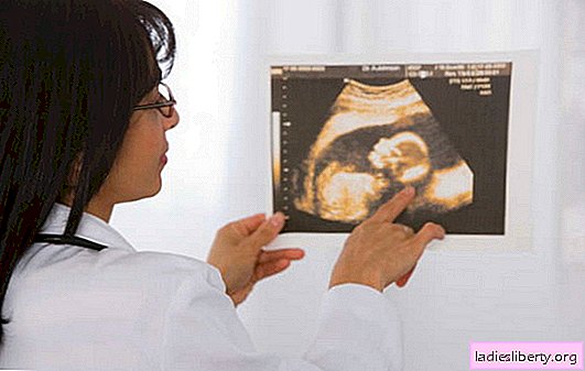 Apa scăzută în timpul sarcinii - afectează nașterea? Cum să scapi de oligohidramnios în timpul sarcinii și să nu-ți pierzi copilul?