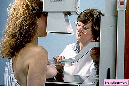 Mammographie: Mehr Nutzen oder Schaden?