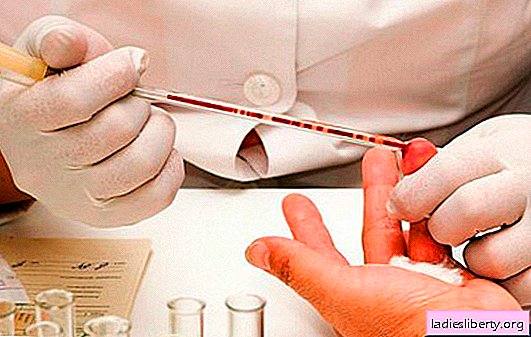 È possibile bere acqua prima del test del sangue? Raccomandazioni di esperti: se bere acqua prima di donare il sangue