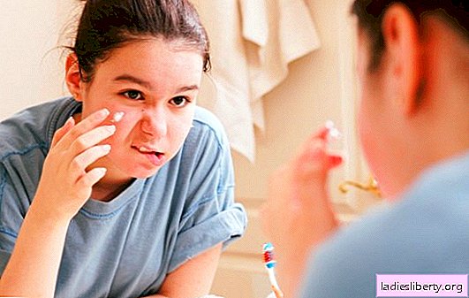 Rimedi popolari per l'acne - rendono la pelle liscia e uniforme. Con quali rimedi popolari puoi sbarazzarti dell'acne?