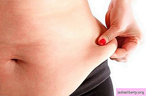 Skin sagging after losing weight - what to do? How to tighten and make the skin more elastic after losing weight.