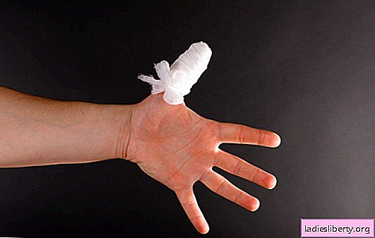 Svullna finger, öm nagel: orsakar inflammation. Hur behandlar du en öm plats själv hemma?