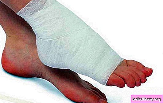 Hinchazón de la articulación del tobillo: causas de este doloroso problema. Dolor en la articulación del tobillo: cómo tratarlo y qué hacer