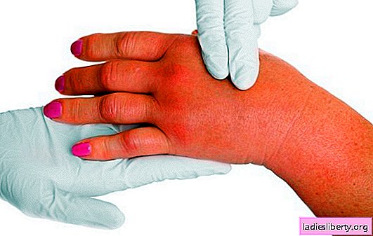 Swollen brush and sore: the most common causes. How to treat and combat a pathological condition?