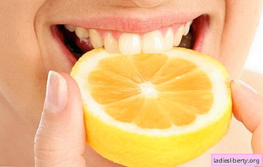 Blanquear los dientes con limón es una sonrisa de Hollywood en casa. Cómo blanquear tus dientes con limón y gaseosa de forma segura