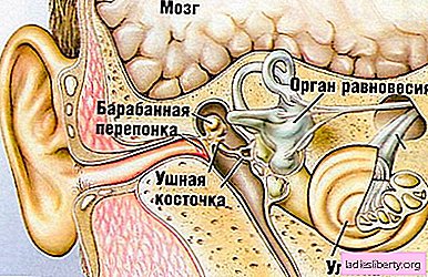 التهاب الأذن الوسطى - الأسباب والأعراض والتشخيص والعلاج