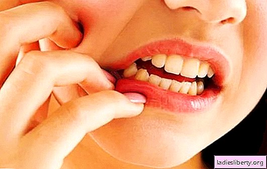 Periodontitis: ¿tratamiento en casa o al médico? ¿Es posible tratar la periodontitis en casa sin medicamentos?