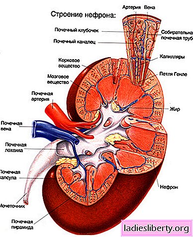 腎lone腎炎-原因、症状、診断、治療